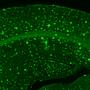 Fortschreiten der Alzheimer-Erkrankung an einzelnen Neuronen zu sehen