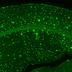 Fortschreiten der Alzheimer-Erkrankung an einzelnen Neuronen zu sehen