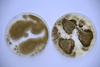 Aspergillus