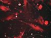 molécula fluorescente rodamina en fibroblastos senescentes