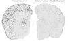 Brain hemisphere of an Alzheimer’s mouse
