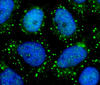 New insights into the signaling network of the vital protein mTOR