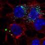 Transmission routes of spreading protein particles