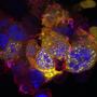 How Alzheimer’s could occur