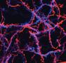 Calcium in the nucleus renders neurons chronically sensitive to pain