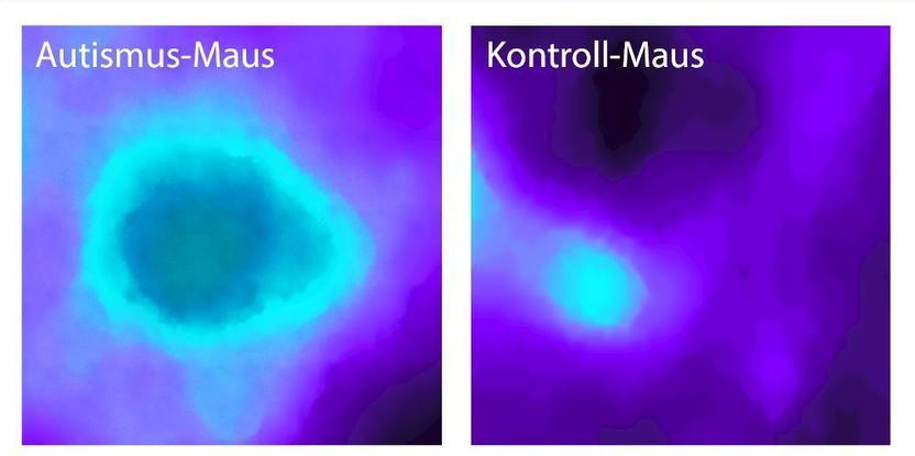 Insular Cortex Alterations In Mouse >> Insular Cortex Alterations In Mouse Models Of Autism Insular Cortex Alterations In Mouse >> Insular Cortex Alterations In Mouse Models Of Autism