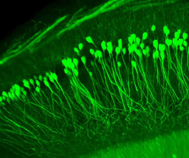 macro and 3d imaging with cellular resolution using light sheet laser light sheet