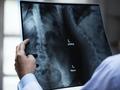 Ultraschall kann Röntgen oft ersetzen