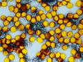 Zika und Gelbfieber: Impfstoffe ohne Ei