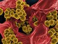 Understanding antibiotic resistance in patients with cystic fibrosis