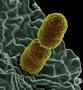 Wie Bakterien ein Antibiotikum ausschalten