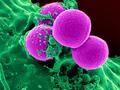 Computer model shows how to better control MRSA outbreaks