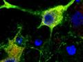 Identifizierung eines für die Regeneration nach einem Schlaganfall entscheidenden Gehirnproteins