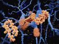 Identifizierung der molekularen Struktur eines der klebrigeren Verursacher von Alzheimer