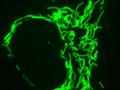 It's not an antibody, it's a frankenbody: A new tool for live-cell imaging
