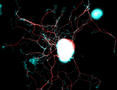 Schlüsselproteine für die Reparatur von Nervenleitungen identifiziert
