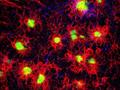 Zusammenhang zwischen Gehirnimmunzellen und der Entwicklung der Alzheimer-Krankheit identifiziert
