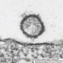 Schmallenberg-Virus erstmals sichtbar gemacht_1