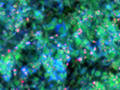 Durchbruch in der Mikroskopie: Biomolekülen beim Tanzen zusehen