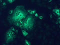 El sistema de desechos celulares se deshace del coronavirus