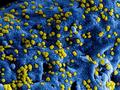 Remdesivir verhindert MERS-Coronavirus-Krankheit bei Affen