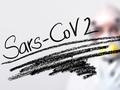 Neues Verfahren für Neutralisationstests auf SARS-CoV-2