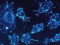 Las células del cáncer de mama convierten a las células inmunes asesinas en aliadas