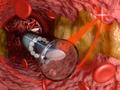 Las imágenes del interior de los vasos sanguíneos