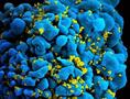 La droga para la esclerosis múltiple bloquea la infección y la transmisión del VIH en las células inmunes humanas