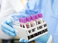 Blut-basierter Test identifiziert Virusinfektion bevor sich Symptome entwickeln
