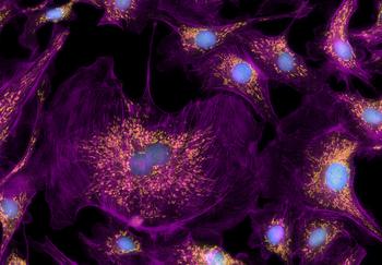 40-fach: Digital Confocal-Bilder von BPAE-Zellen, aufgenommen mit ImageXpress Pico