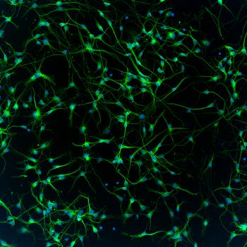 20-fach: Neuronen, mit ImageXpress Pico aufgenommen