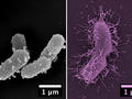Forscher finden das Leibgericht eines Darmbakteriums