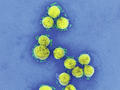 Neuer SARS-CoV-2 neutralisierender Antikörper wird klinisch geprüft