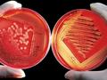 Wie sich Bakterien bei Antibiotikaangriffen schlafend stellen