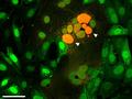 Gewebeschäden durch Zellfusion in COVID-19 und die Rolle des Spikeproteins