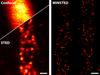 Neue Mikroskopie-Methode löst Fluoreszenzmoleküle nanometergenau auf