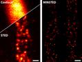 Neue Mikroskopie-Methode löst Fluoreszenzmoleküle nanometergenau auf