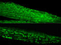 Oben: Mitochondrien im gesunden Muskel von C. elegans. Unten: fragmentierte Mitochondrien im Muskel, nachdem Aggregation von Proteinen in der Keimbahn induziert wurde.