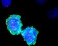 Reparaturmechanismus von Tumorzellen gezielt ausschalten