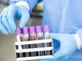 Seasonal temperature impacts patient lab results