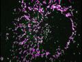 Deadly combination: new direct trigger for cell death discovered