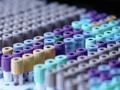PCR-Labore vor schwierigen Investitionsentscheidungen
