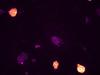 Immunfluoreszenzmikroskopische Aufnahmen zeigen die unterschiedliche Morphologie von reprogrammierten pluripotenten Stammzellen (orange) und Zellen, die nicht reprogrammiert wurden (lila).