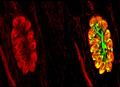 Toxoplasmosis: propagación del parásito en la célula huésped detenida