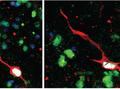 Zwei Beispiele für neugeborene unreife Dentate-Granula-Neuronen in den chirurgischen Proben des adulten menschlichen Hippocampus in Kultur, markiert mit überlappenden Markersignalen von unreifen Neuronen (rot), Dentate-Granula-Neuronen (grün), Zellkernen (blau) und neugeborenen Zellen, die mit synthetischen Nukleosidanaloga markiert sind (weiß).