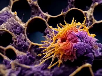 Forschende wandeln Krebszellen in weniger schädliche Zelltypen um