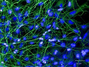 Aus menschlichen iPS-Zellen generierte Nervenzellen