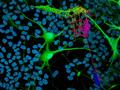 Initiative taps scientists to create atlas of cells in human spinal cord