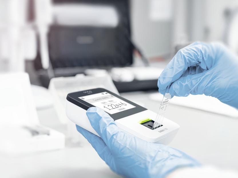 Präzise und zuverlässige Zellzählung mit holografischer Mikroskopie und maschinellen Lernalgorithmen - - In dieser Studie haben wir die Leistung eines Zellzählers gemäß der CLSI EP05-A32 bewertet. - Vimarsana News